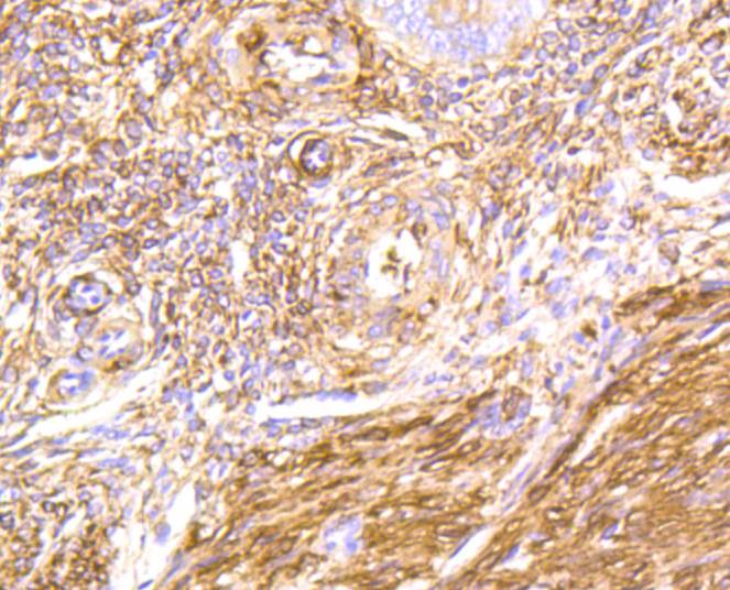 Immunohistochemical analysis of paraffin-embedded human uterus tissue using anti-Filamin A antibody. The section was pre-treated using heat mediated antigen retrieval with Tris-EDTA buffer (pH 8.0-8.4) for 20 minutes.The tissues were blocked in 5% BSA for 30 minutes at room temperature, washed with ddH2O and PBS, and then probed with the primary antibody (ET1601-3, 1/100) for 30 minutes at room temperature. The detection was performed using an HRP conjugated compact polymer system. DAB was used as the chromogen. Tissues were counterstained with hematoxylin and mounted with DPX.