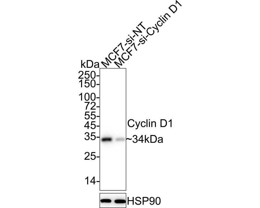 Western blot analysis of Cyclin D1 on SH-SY5Y cell lysates with Rabbit anti-Cyclin D1 antibody (ET1601-31) at 1/2,000 dilution.<br />
<br />
Lysates/proteins at 10 µg/Lane.<br />
<br />
Predicted band size: 34 kDa<br />
Observed band size: 35 kDa<br />
<br />
Exposure time: 1 minute;<br />
<br />
12% SDS-PAGE gel.<br />
<br />
Proteins were transferred to a PVDF membrane and blocked with 5% NFDM/TBST for 1 hour at room temperature. The primary antibody (ET1601-31) at 1/2,000 dilution was used in 5% NFDM/TBST at room temperature for 2 hours. Goat Anti-Rabbit IgG - HRP Secondary Antibody (HA1001) at 1:300,000 dilution was used for 1 hour at room temperature.