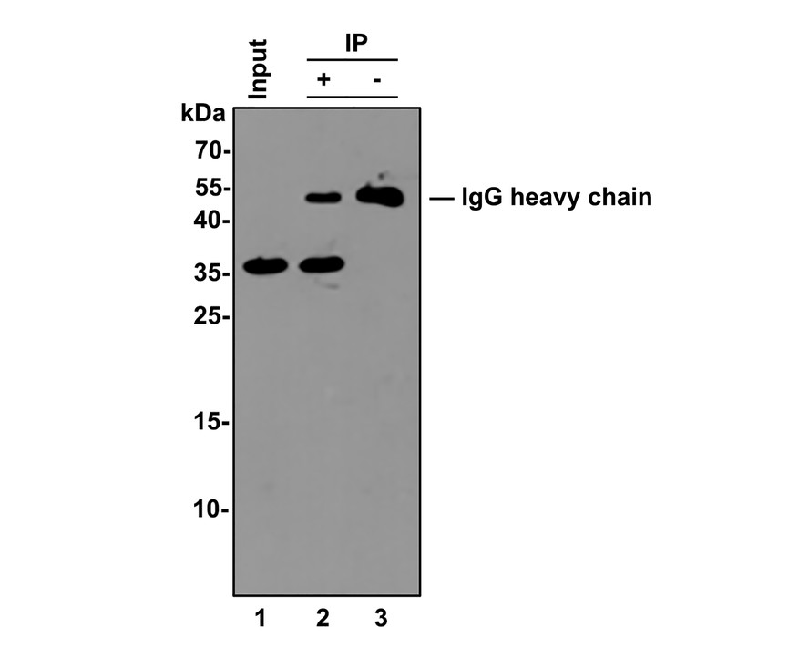 Cyclin D1 was immunoprecipitated from 0.5 mg Hela whole cell lysates with ET1601-31 at 2 μg/mL. Western blot was performed from the immunoprecipitate using ET1601-31 at 1/500 dilution for 45 minutes at room temperature. Goat anti-Rabbit IgG-HRP Secondary Antibody (HA1001) was used at 1:300,000 dilution for 30 minutes at room temperature.<br />
<br />
Lane 1: Hela whole cell lysates at 10 μg;<br />
Lane 2: Cyclin D1 (ET1601-31) IP in Hela whole cell lysates;<br />
Lane 3: Rabbit IgG instead of Cyclin D1 (ET1601-31) in Hela whole cell lysates.<br />
<br />
Predicted band size: 34 kDa<br />
Observed band size: 34 kDa<br />
<br />
Exposure time: 5 minutes;<br />
<br />
12% SDS-PAGE gel.