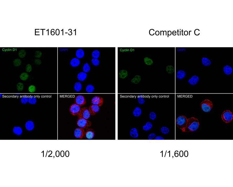 ICC staining of Cyclin D1 in PC-12 cells (green). Formalin fixed cells were permeabilized with 0.1% Triton X-100 in TBS for 10 minutes at room temperature and blocked with 1% Blocker BSA for 15 minutes at room temperature. Cells were probed with the primary antibody (ET1601-31, 1/50) for 1 hour at room temperature, washed with PBS. Alexa Fluor®488 Goat anti-Rabbit IgG was used as the secondary antibody at 1/1,000 dilution. The nuclear counter stain is DAPI (blue).