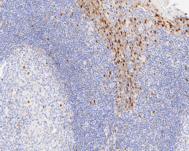 Immunohistochemical analysis of paraffin-embedded human small intestine tissue using anti-Cyclin D1 antibody. The section was pre-treated using heat mediated antigen retrieval with sodium citrate buffer (pH 6.0) for 2 minutes. The tissues were blocked in 5% BSA for 30 minutes at room temperature, washed with ddH2O and PBS, and then probed with the primary antibody (ET1601-31, 1/200)  for 30 minutes at room temperature. The detection was performed using an HRP conjugated compact polymer system. DAB was used as the chromogen. Tissues were counterstained with hematoxylin and mounted with DPX.