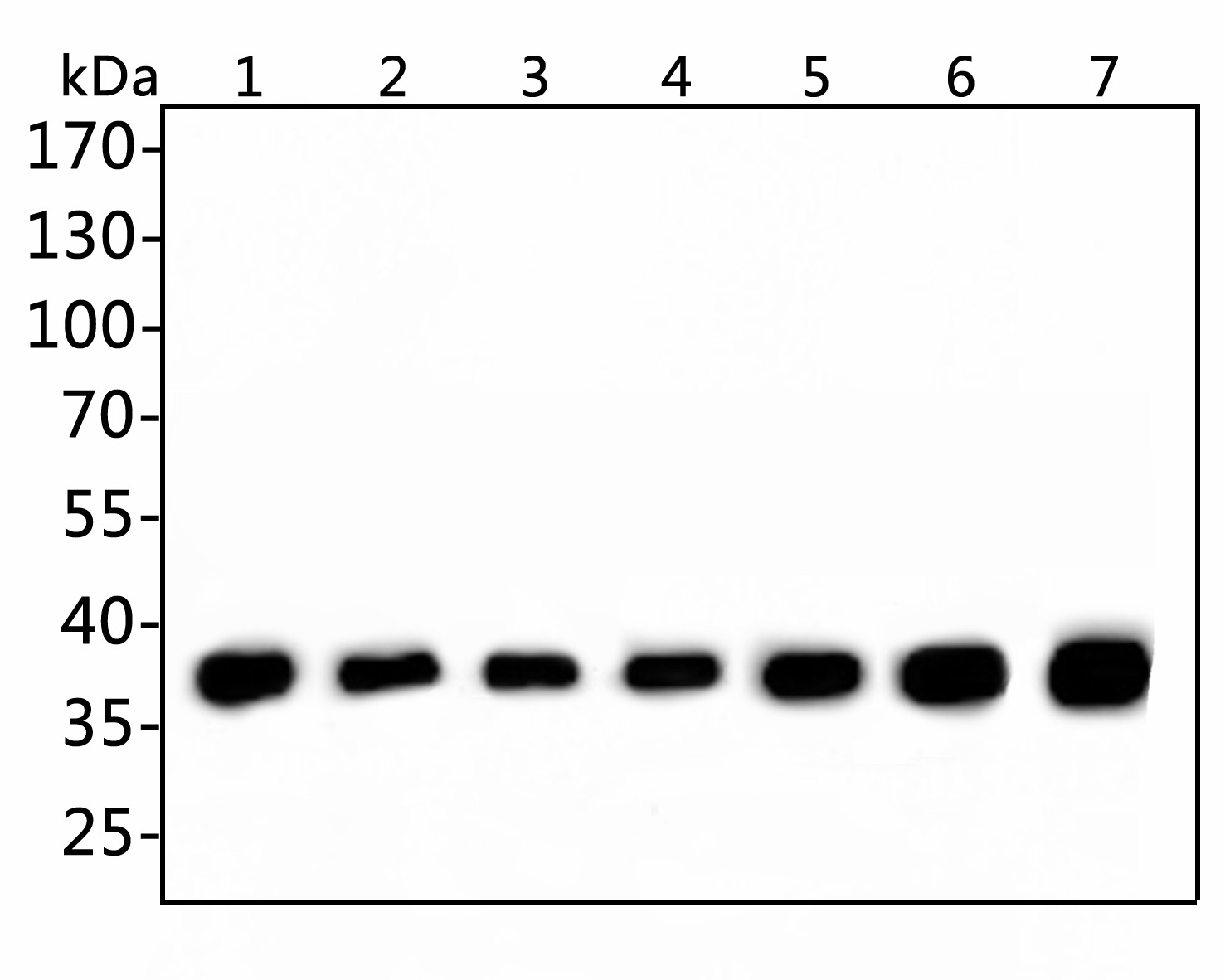 Western blot analysis of GAPDH on different lysates. Proteins were transferred to a PVDF membrane and blocked with 5% NFDM/TBST for 1 hour at room temperature. The primary antibody (ET1601-4, 1/5,000) was used in 5% NFDM/TBST at room temperature for 1 hour. Goat Anti-Rabbit IgG - HRP Secondary Antibody (HA1001) at 1:200,000 dilution was used for 45 mins at room temperature.<br />
<br />
Positive control: <br />
Lane 1: PC-3 cell lysate, 10 µg/Lane<br />
Lane 2: Mouse colon tissue lysate, 20 µg/Lane<br />
Lane 3: SH-SY5Y cell lysate, 10 µg/Lane<br />
Lane 4: PC-3 cell lysate, 10 µg/Lane<br />
Lane 5: NIH/3T3 cell lysate, 10 µg/Lane<br />
Lane 6: SK-Br-3 cell lysate, 10 µg/Lane<br />
Lane 7: Rat brain tissue lysate, 20 µg/Lane