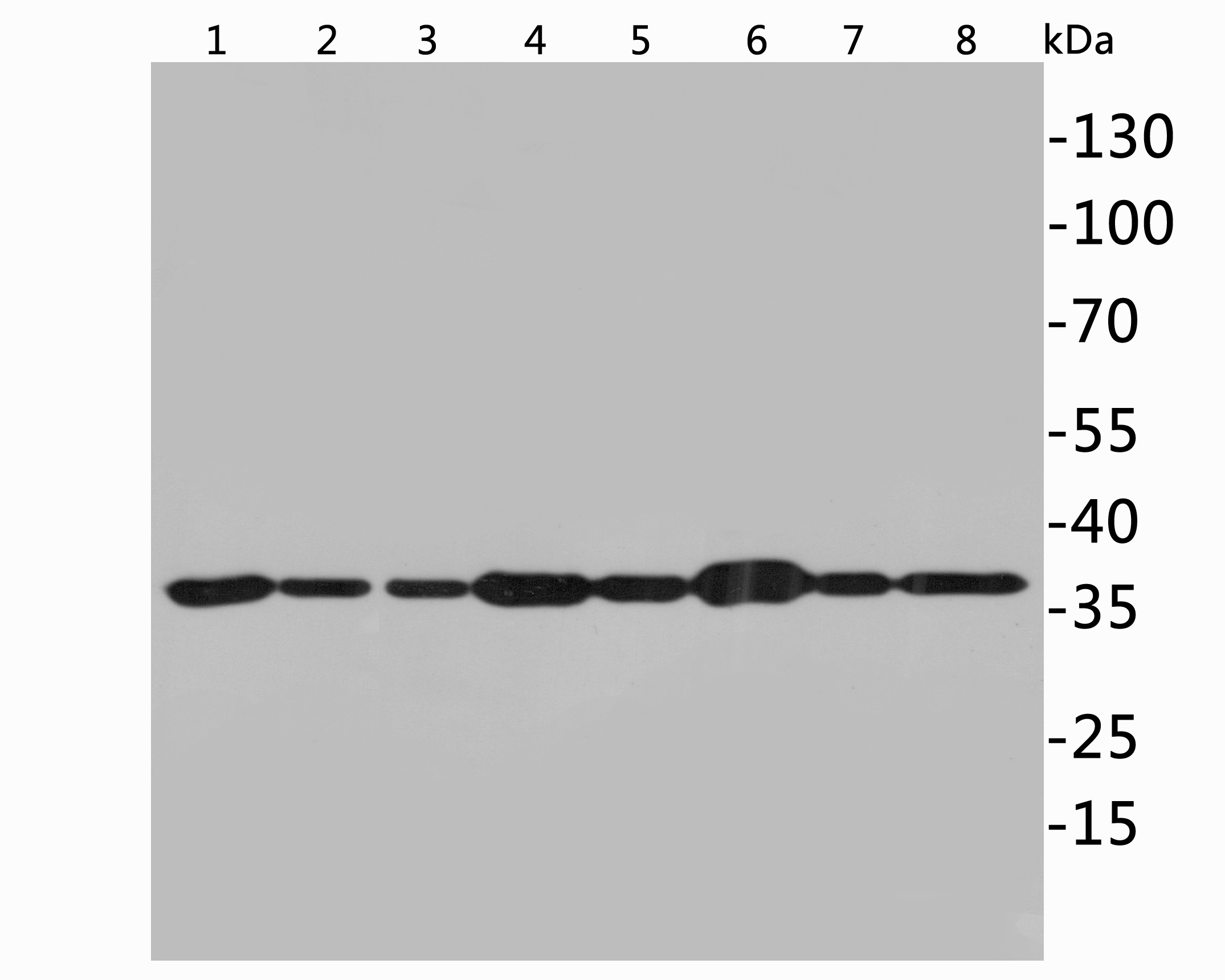 Western blot analysis of GAPDH on different lysates. Proteins were transferred to a PVDF membrane and blocked with 5% NFDM/TBST for 1 hour at room temperature. The primary antibody (ET1601-4, 1/10,000) was used in 5% NFDM/TBST at room temperature for 1 hour. Goat Anti-Rabbit IgG - HRP Secondary Antibody (HA1001) at 1:200,000 dilution was used for 45 mins at room temperature.<br />
<br />
Positive control: <br />
Lane 1: Rat liver tissue lysate, 20 µg/Lane<br />
Lane 2: Rat lung tissue lysate, 20 µg/Lane<br />
Lane 3: Rat lung tissue lysate, 20 µg/Lane<br />
Lane 4: Rat heart tissue lysate, 20 µg/Lane<br />
Lane 5: Rat cerebellum tissue lysate, 20 µg/Lane<br />
Lane 6: Rat skeletal muscle tissue lysate, 20 µg/Lane<br />
Lane 7: Rat spleen tissue lysate, 20 µg/Lane<br />
Lane 8: Rat small intestine tissue lysate, 20 µg/Lane