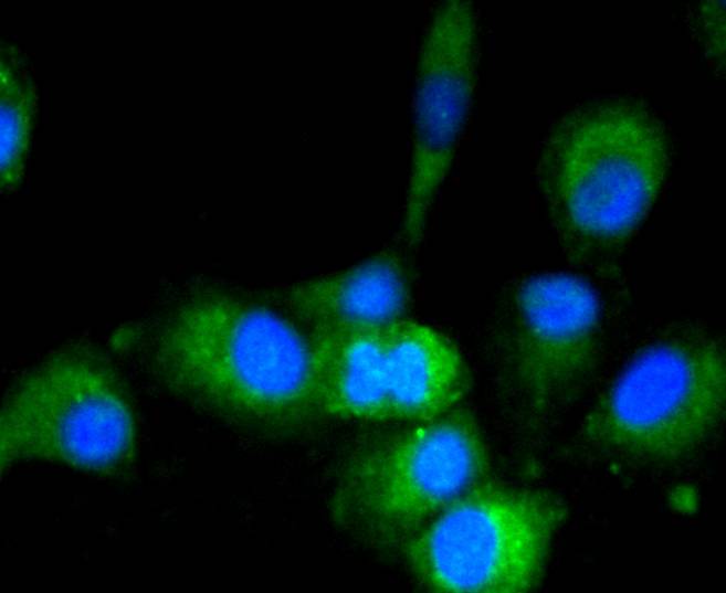 ICC staining of GAPDH in HepG2 cells (green). Formalin fixed cells were permeabilized with 0.1% Triton X-100 in TBS for 10 minutes at room temperature and blocked with 1% Blocker BSA for 15 minutes at room temperature. Cells were probed with the primary antibody (ET1601-4, 1/50) for 1 hour at room temperature, washed with PBS. Alexa Fluor®488 Goat anti-Rabbit IgG was used as the secondary antibody at 1/1,000 dilution. The nuclear counter stain is DAPI (blue).