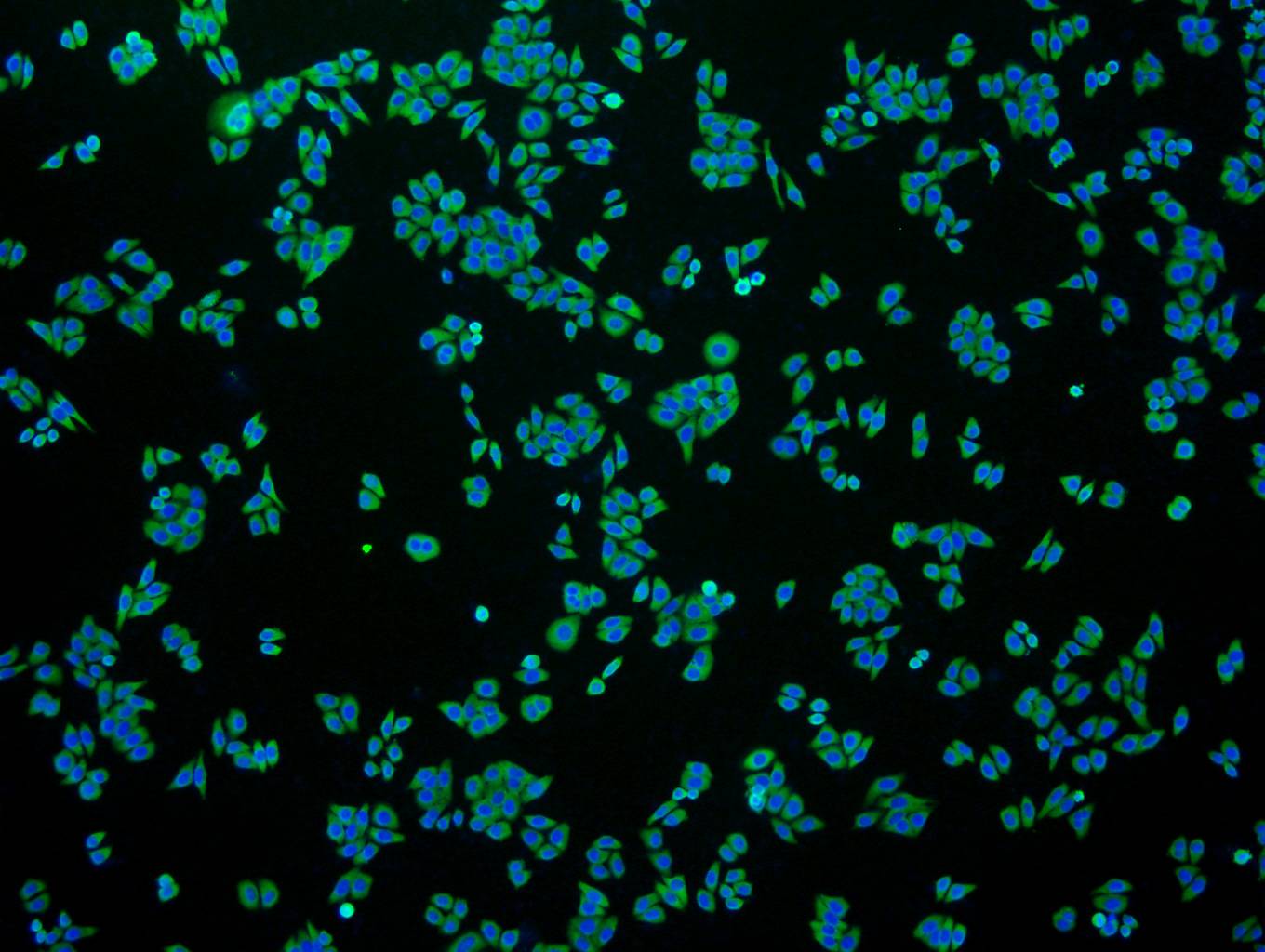 Immunohistochemical analysis of paraffin-embedded human liver tissue using anti-GAPDH antibody. The section was pre-treated using heat mediated antigen retrieval with Tris-EDTA buffer (pH 8.0-8.4) for 20 minutes.The tissues were blocked in 5% BSA for 30 minutes at room temperature, washed with ddH2O and PBS, and then probed with the primary antibody (ET1601-4, 1/50) for 30 minutes at room temperature. The detection was performed using an HRP conjugated compact polymer system. DAB was used as the chromogen. Tissues were counterstained with hematoxylin and mounted with DPX.