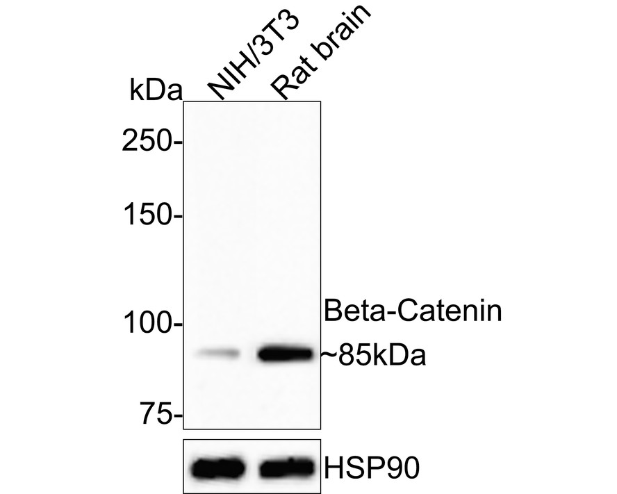 Immunohistochemical analysis of paraffin-embedded human colon carcinoma tissue using anti-Beta-Catenin antibody. The section was pre-treated using heat mediated antigen retrieval with Tris-EDTA buffer (pH 8.0-8.4) for 20 minutes.The tissues were blocked in 5% BSA for 30 minutes at room temperature, washed with ddH2O and PBS, and then probed with the primary antibody (ET1601-5, 1/50) for 30 minutes at room temperature. The detection was performed using an HRP conjugated compact polymer system. DAB was used as the chromogen. Tissues were counterstained with hematoxylin and mounted with DPX.