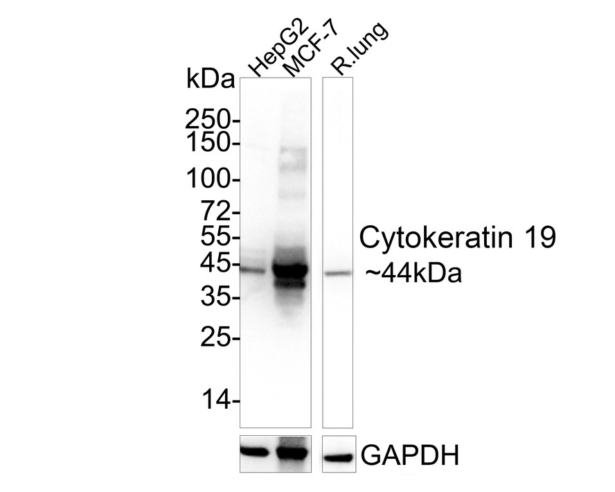 All lanes: Western blot analysis of Cytokeratin 19 with anti-Cytokeratin 19 antibody [SA30-06] (ET1601-6) at 1:5,000 dilution.<br />
Lane 1: Wild-type HepG2 whole cell lysate (20 µg).<br />
Lane 2/3: Cytokeratin 19 knockout HepG2 whole cell lysate (20 µg).<br />
<br />
ET1601-6 was shown to specifically react with Cytokeratin 19 in wild-type HepG2 cells. No band was observed when Cytokeratin 19 knockout samples were tested. Wild-type and Cytokeratin 19 knockout samples were subjected to SDS-PAGE. Proteins were transferred to a PVDF membrane and blocked with 5% NFDM in TBST for 1 hour at room temperature. The primary Anti-Cytokeratin 19 Antibody (ET1601-6, 1/5,000) and anti-HSP90 antibody (ET1605-56, 1/10,000) were used in 5% BSA at room temperature for 2 hours. Goat Anti-Rabbit IgG H&L (HRP) Secondary Antibody (HA1001) at 1:200,000 dilution was used for 1 hour at room temperature.