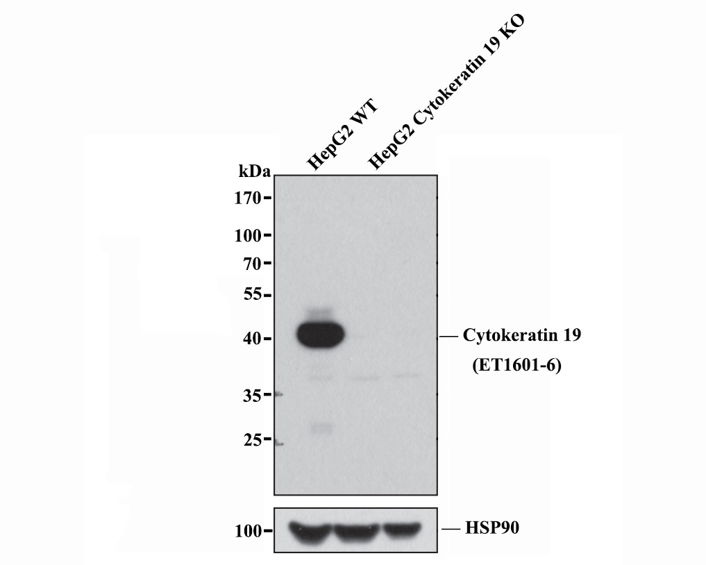 Western blot analysis of Cytokeratin 19 on MCF-7 cell lysates. Proteins were transferred to a PVDF membrane and blocked with 5% BSA in PBS for 1 hour at room temperature. The primary antibody (ET1601-6, 1/500) was used in 5% BSA at room temperature for 2 hours. Goat Anti-Rabbit IgG - HRP Secondary Antibody (HA1001) at 1:5,000 dilution was used for 1 hour at room temperature.