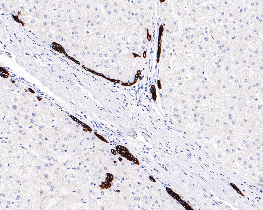 Immunohistochemical analysis of paraffin-embedded human liver tissue using anti-Cytokeratin 19 antibody. The section was pre-treated using heat mediated antigen retrieval with Tris-EDTA buffer (pH 8.0-8.4) for 20 minutes.The tissues were blocked in 5% BSA for 30 minutes at room temperature, washed with ddH2O and PBS, and then probed with the primary antibody (ET1601-6, 1/50) for 30 minutes at room temperature. The detection was performed using an HRP conjugated compact polymer system. DAB was used as the chromogen. Tissues were counterstained with hematoxylin and mounted with DPX.