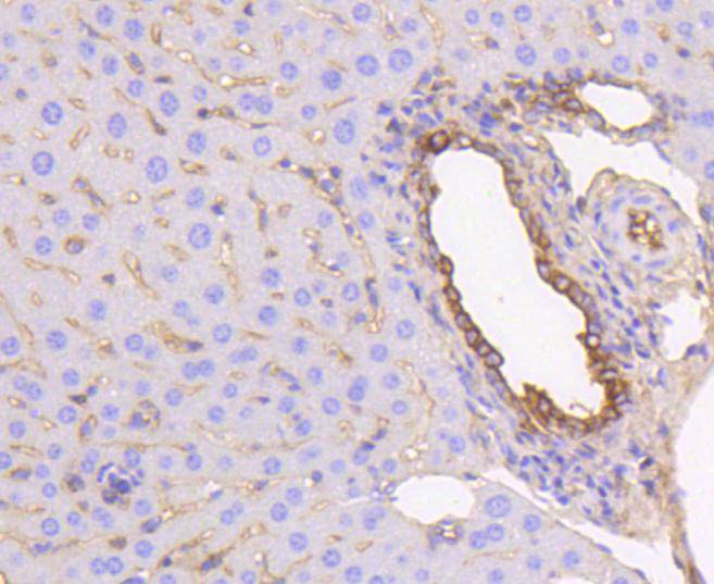 Immunohistochemical analysis of paraffin-embedded mouse liver tissue using anti-Cytokeratin 19 antibody. The section was pre-treated using heat mediated antigen retrieval with Tris-EDTA buffer (pH 8.0-8.4) for 20 minutes.The tissues were blocked in 5% BSA for 30 minutes at room temperature, washed with ddH2O and PBS, and then probed with the primary antibody (ET1601-6, 1/50) for 30 minutes at room temperature. The detection was performed using an HRP conjugated compact polymer system. DAB was used as the chromogen. Tissues were counterstained with hematoxylin and mounted with DPX.