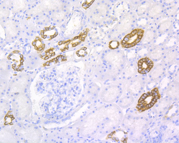 Immunohistochemical analysis of paraffin-embedded human kidney tissue using anti-Cytokeratin 19 antibody. The section was pre-treated using heat mediated antigen retrieval with Tris-EDTA buffer (pH 8.0-8.4) for 20 minutes.The tissues were blocked in 5% BSA for 30 minutes at room temperature, washed with ddH2O and PBS, and then probed with the primary antibody (ET1601-6, 1/400) for 30 minutes at room temperature. The detection was performed using an HRP conjugated compact polymer system. DAB was used as the chromogen. Tissues were counterstained with hematoxylin and mounted with DPX.