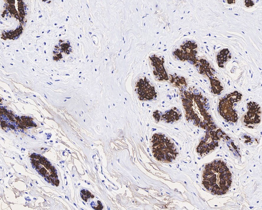 Immunohistochemical analysis of paraffin-embedded human placenta tissue using anti-Cytokeratin 19 antibody. The section was pre-treated using heat mediated antigen retrieval with Tris-EDTA buffer (pH 8.0-8.4) for 20 minutes.The tissues were blocked in 5% BSA for 30 minutes at room temperature, washed with ddH2O and PBS, and then probed with the primary antibody (ET1601-6, 1/50) for 30 minutes at room temperature. The detection was performed using an HRP conjugated compact polymer system. DAB was used as the chromogen. Tissues were counterstained with hematoxylin and mounted with DPX.