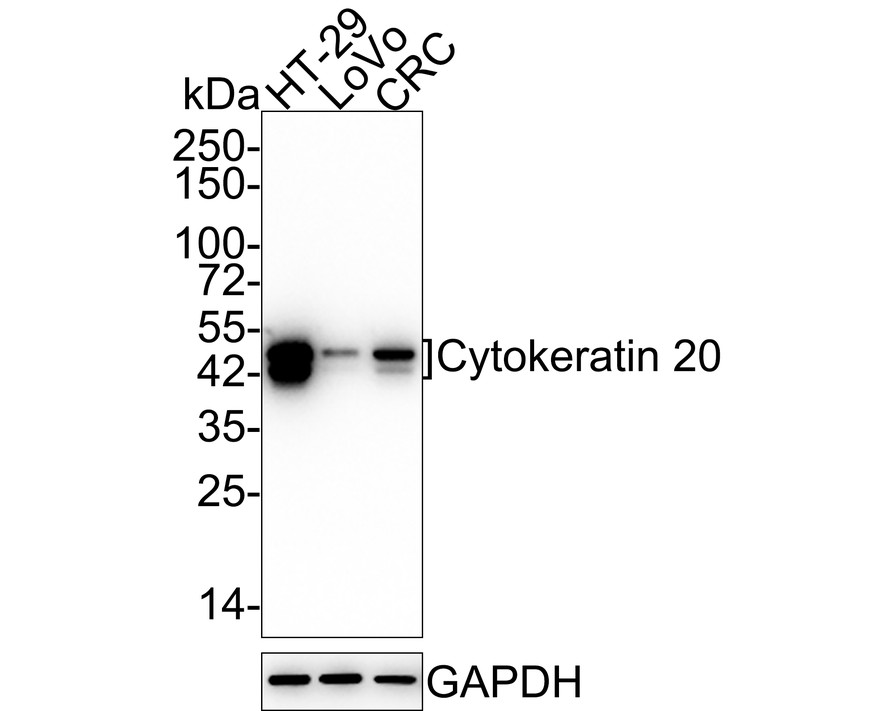 Western blot analysis of Cytokeratin 20 on different lysates with Rabbit anti-Cytokeratin 20 antibody (ET1601-8) at 1/500 dilution.<br />
<br />
Lane 1: LOVO cell lysate<br />
Lane 2: HCT116 cell lysate<br />
<br />
Lysates/proteins at 10 µg/Lane.<br />
<br />
Predicted band size: 48 kDa<br />
Observed band size: 48 kDa<br />
<br />
Exposure time: 2 minutes;<br />
<br />
12% SDS-PAGE gel.<br />
<br />
Proteins were transferred to a PVDF membrane and blocked with 5% NFDM/TBST for 1 hour at room temperature. The primary antibody (ET1601-8) at 1/500 dilution was used in 5% NFDM/TBST at room temperature for 2 hours. Goat Anti-Rabbit IgG - HRP Secondary Antibody (HA1001) at 1:300,000 dilution was used for 1 hour at room temperature.