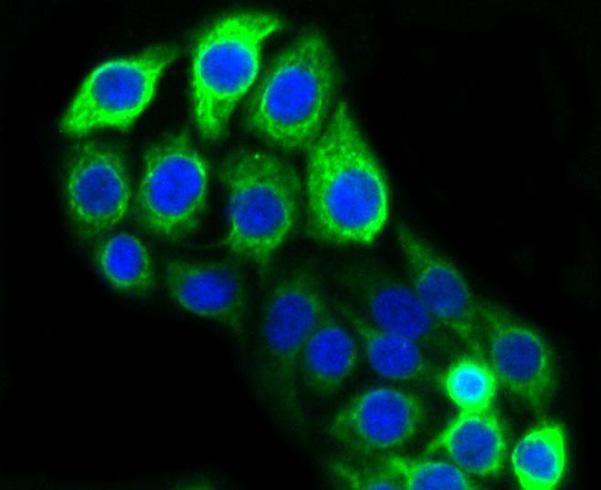 ICC staining of Cytokeratin 20 in CRC cells (green). Formalin fixed cells were permeabilized with 0.1% Triton X-100 in TBS for 10 minutes at room temperature and blocked with 1% Blocker BSA for 15 minutes at room temperature. Cells were probed with the primary antibody (ET1601-8, 1/50) for 1 hour at room temperature, washed with PBS. Alexa Fluor®488 Goat anti-Rabbit IgG was used as the secondary antibody at 1/1,000 dilution. The nuclear counter stain is DAPI (blue).
