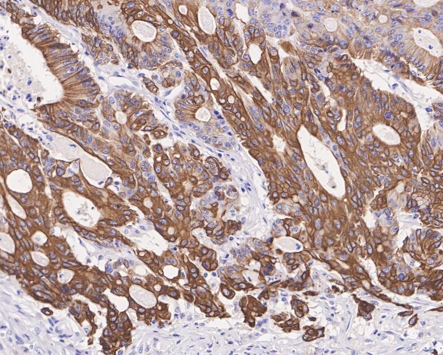 Immunohistochemical analysis of paraffin-embedded rat small intestine tissue using anti-Cytokeratin 20 antibody. The section was pre-treated using heat mediated antigen retrieval with Tris-EDTA buffer (pH 8.0-8.4) for 20 minutes.The tissues were blocked in 5% BSA for 30 minutes at room temperature, washed with ddH2O and PBS, and then probed with the primary antibody (ET1601-8, 1/50) for 30 minutes at room temperature. The detection was performed using an HRP conjugated compact polymer system. DAB was used as the chromogen. Tissues were counterstained with hematoxylin and mounted with DPX.