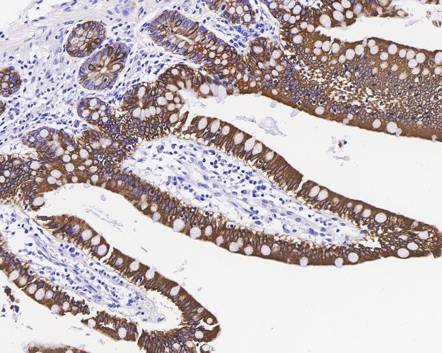 Immunohistochemical analysis of paraffin-embedded human small intestine tissue using anti-Cytokeratin 20 antibody. The section was pre-treated using heat mediated antigen retrieval with Tris-EDTA buffer (pH 9.0) for 20 minutes.The tissues were blocked in 5% BSA for 30 minutes at room temperature, washed with ddH2O and PBS, and then probed with the primary antibody (ET1601-8, 1/200) for 30 minutes at room temperature. The detection was performed using an HRP conjugated compact polymer system. DAB was used as the chromogen. Tissues were counterstained with hematoxylin and mounted with DPX.