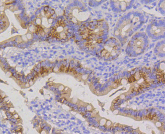 Flow cytometric analysis of Cytokeratin 20 was done on CRC cells. The cells were fixed, permeabilized and stained with the primary antibody (ET1601-8, 1/50) (blue). After incubation of the primary antibody at room temperature for an hour, the cells were stained with a Alexa Fluor 488-conjugated Goat anti-Rabbit IgG Secondary antibody at 1/1,000 dilution for 30 minutes.Unlabelled sample was used as a control (cells without incubation with primary antibody; red).