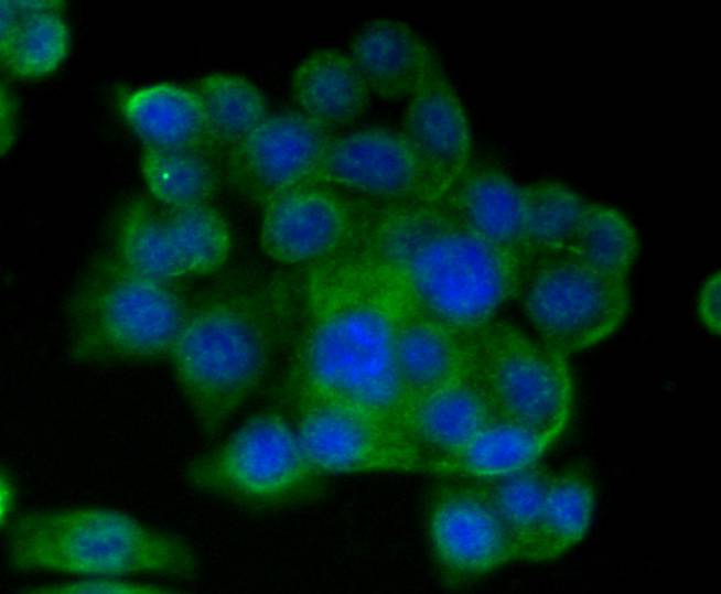 ICC staining of CD9 in SW480 cells (green). Formalin fixed cells were permeabilized with 0.1% Triton X-100 in TBS for 10 minutes at room temperature and blocked with 1% Blocker BSA for 15 minutes at room temperature. Cells were probed with the primary antibody (ET1601-9, 1/50) for 1 hour at room temperature, washed with PBS. Alexa Fluor®488 Goat anti-Rabbit IgG was used as the secondary antibody at 1/1,000 dilution. The nuclear counter stain is DAPI (blue).