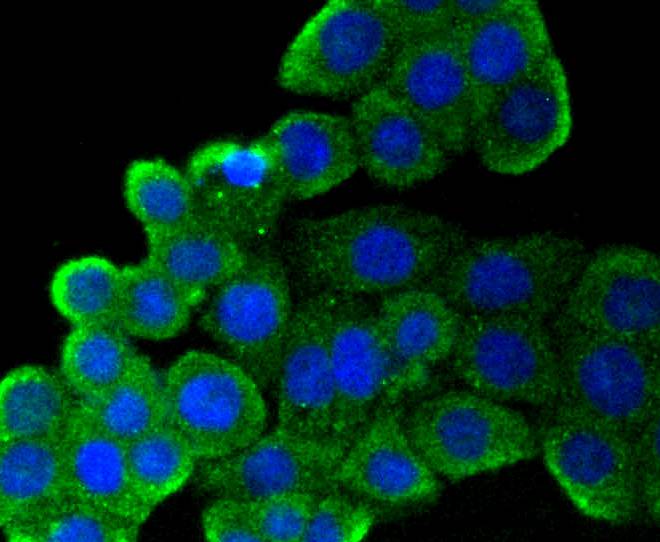 ICC staining of CD9 in CRC cells (green). Formalin fixed cells were permeabilized with 0.1% Triton X-100 in TBS for 10 minutes at room temperature and blocked with 1% Blocker BSA for 15 minutes at room temperature. Cells were probed with the primary antibody (ET1601-9, 1/50) for 1 hour at room temperature, washed with PBS. Alexa Fluor®488 Goat anti-Rabbit IgG was used as the secondary antibody at 1/1,000 dilution. The nuclear counter stain is DAPI (blue).