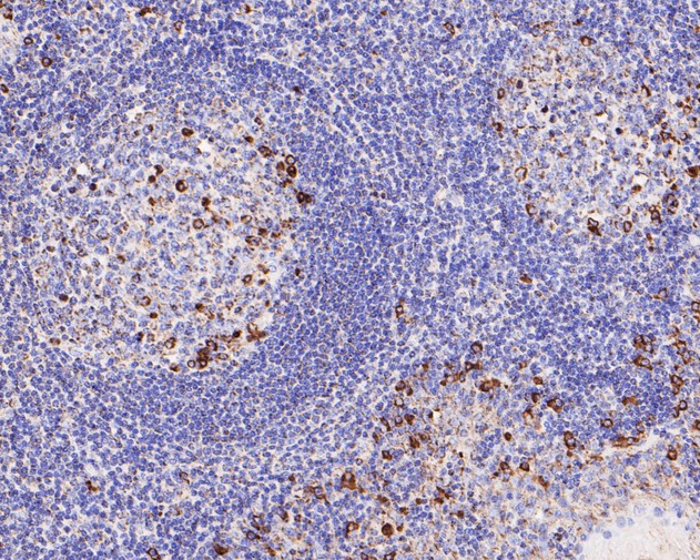 Immunohistochemical analysis of paraffin-embedded human tonsil tissue using anti-CD9 antibody. The section was pre-treated using heat mediated antigen retrieval with Tris-EDTA buffer (pH 8.0-8.4) for 20 minutes.The tissues were blocked in 5% BSA for 30 minutes at room temperature, washed with ddH2O and PBS, and then probed with the primary antibody (ET1601-9, 1/200) for 30 minutes at room temperature. The detection was performed using an HRP conjugated compact polymer system. DAB was used as the chromogen. Tissues were counterstained with hematoxylin and mounted with DPX.