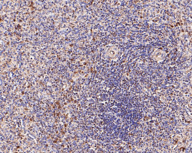 Immunohistochemical analysis of paraffin-embedded human spleen tissue using anti-CD9 antibody. The section was pre-treated using heat mediated antigen retrieval with Tris-EDTA buffer (pH 8.0-8.4) for 20 minutes.The tissues were blocked in 5% BSA for 30 minutes at room temperature, washed with ddH2O and PBS, and then probed with the primary antibody (ET1601-9, 1/200) for 30 minutes at room temperature. The detection was performed using an HRP conjugated compact polymer system. DAB was used as the chromogen. Tissues were counterstained with hematoxylin and mounted with DPX.