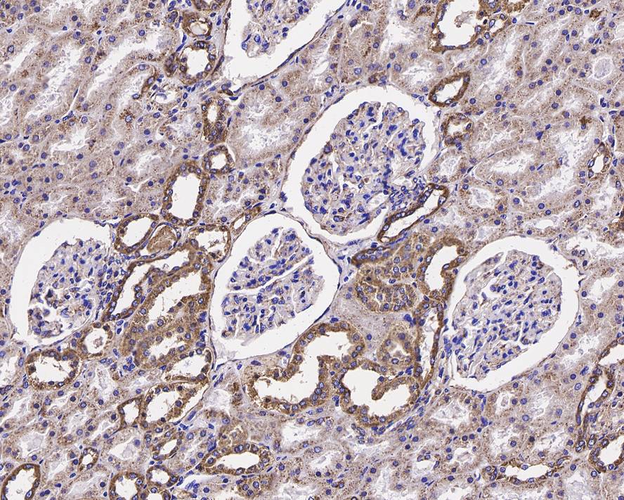 Immunohistochemical analysis of paraffin-embedded human kidney tissue using anti-CD9 antibody. The section was pre-treated using heat mediated antigen retrieval with Tris-EDTA buffer (pH 8.0-8.4) for 20 minutes.The tissues were blocked in 5% BSA for 30 minutes at room temperature, washed with ddH2O and PBS, and then probed with the primary antibody (ET1601-9, 1/50) for 30 minutes at room temperature. The detection was performed using an HRP conjugated compact polymer system. DAB was used as the chromogen. Tissues were counterstained with hematoxylin and mounted with DPX.