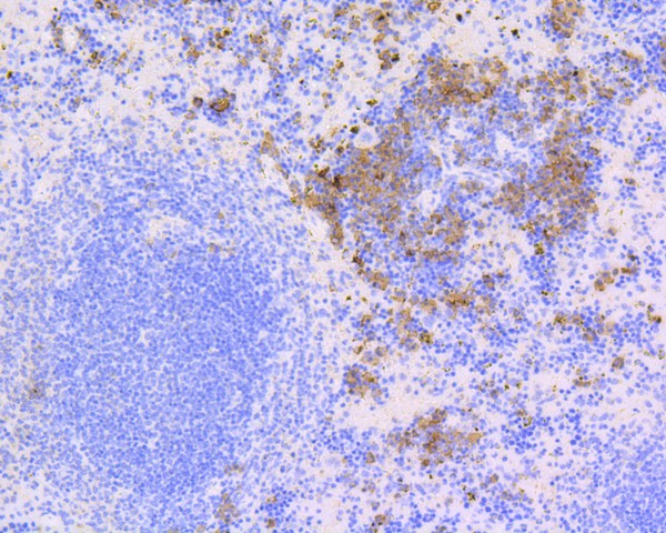 Immunohistochemical analysis of paraffin-embedded mouse spleen tissue using anti-CD9 antibody. The section was pre-treated using heat mediated antigen retrieval with Tris-EDTA buffer (pH 8.0-8.4) for 20 minutes.The tissues were blocked in 5% BSA for 30 minutes at room temperature, washed with ddH2O and PBS, and then probed with the primary antibody (ET1601-9, 1/50) for 30 minutes at room temperature. The detection was performed using an HRP conjugated compact polymer system. DAB was used as the chromogen. Tissues were counterstained with hematoxylin and mounted with DPX.