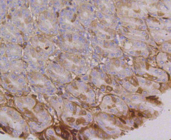 Immunohistochemical analysis of paraffin-embedded human colon carcinoma tissue using anti-Integrin alpha 6 antibody. The section was pre-treated using heat mediated antigen retrieval with Tris-EDTA buffer (pH 8.0-8.4) for 20 minutes.The tissues were blocked in 5% BSA for 30 minutes at room temperature, washed with ddH2O and PBS, and then probed with the primary antibody (ET1602-1, 1/50) for 30 minutes at room temperature. The detection was performed using an HRP conjugated compact polymer system. DAB was used as the chromogen. Tissues were counterstained with hematoxylin and mounted with DPX.