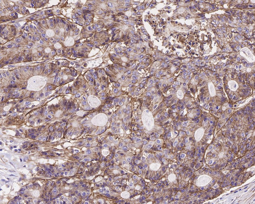 Immunohistochemical analysis of paraffin-embedded mouse colon tissue using anti-Integrin alpha 6 antibody. The section was pre-treated using heat mediated antigen retrieval with Tris-EDTA buffer (pH 8.0-8.4) for 20 minutes.The tissues were blocked in 5% BSA for 30 minutes at room temperature, washed with ddH2O and PBS, and then probed with the primary antibody (ET1602-1, 1/50) for 30 minutes at room temperature. The detection was performed using an HRP conjugated compact polymer system. DAB was used as the chromogen. Tissues were counterstained with hematoxylin and mounted with DPX.