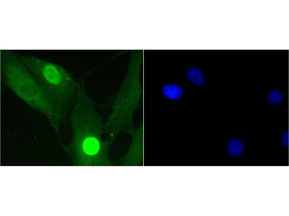ICC staining of Phospho-Histone H1.3(T17)+Histone H1.4(T17) in NIH/3T3 cells (green). Formalin fixed cells were permeabilized with 0.1% Triton X-100 in TBS for 10 minutes at room temperature and blocked with 1% Blocker BSA for 15 minutes at room temperature. Cells were probed with the primary antibody (ET1602-11, 1/50) for 1 hour at room temperature, washed with PBS. Alexa Fluor®488 Goat anti-Rabbit IgG was used as the secondary antibody at 1/1,000 dilution. The nuclear counter stain is DAPI (blue).