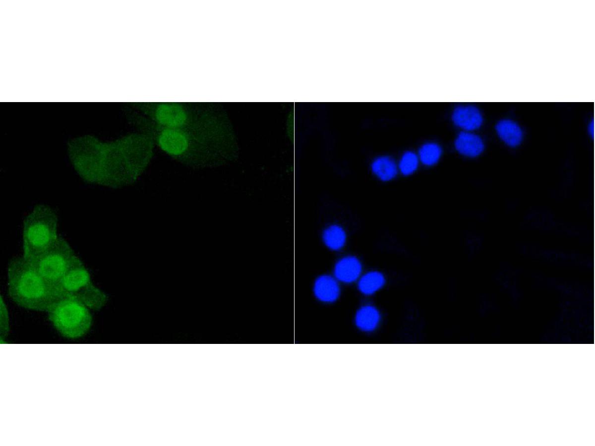 ICC staining of Phospho-Histone H1.3(T17)+Histone H1.4(T17) in CRC cells (green). Formalin fixed cells were permeabilized with 0.1% Triton X-100 in TBS for 10 minutes at room temperature and blocked with 1% Blocker BSA for 15 minutes at room temperature. Cells were probed with the primary antibody (ET1602-11, 1/50) for 1 hour at room temperature, washed with PBS. Alexa Fluor®488 Goat anti-Rabbit IgG was used as the secondary antibody at 1/1,000 dilution. The nuclear counter stain is DAPI (blue).