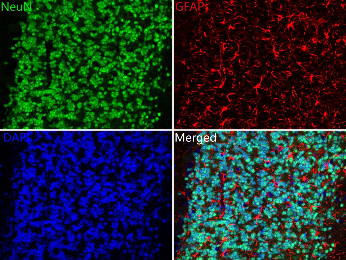 Immunohistochemical analysis of paraffin-embedded mouse brain tissue with Rabbit anti-NeuN antibody (ET1602-12) at 1/500 dilution.<br />
<br />
The section was pre-treated using heat mediated antigen retrieval with sodium citrate buffer (pH 6.0) for 2 minutes. The tissues were blocked in 1% BSA for 20 minutes at room temperature, washed with ddH2O and PBS, and then probed with the primary antibody (ET1602-12) at 1/500 dilution for 1 hour at room temperature. The detection was performed using an HRP conjugated compact polymer system. DAB was used as the chromogen. Tissues were counterstained with hematoxylin and mounted with DPX.