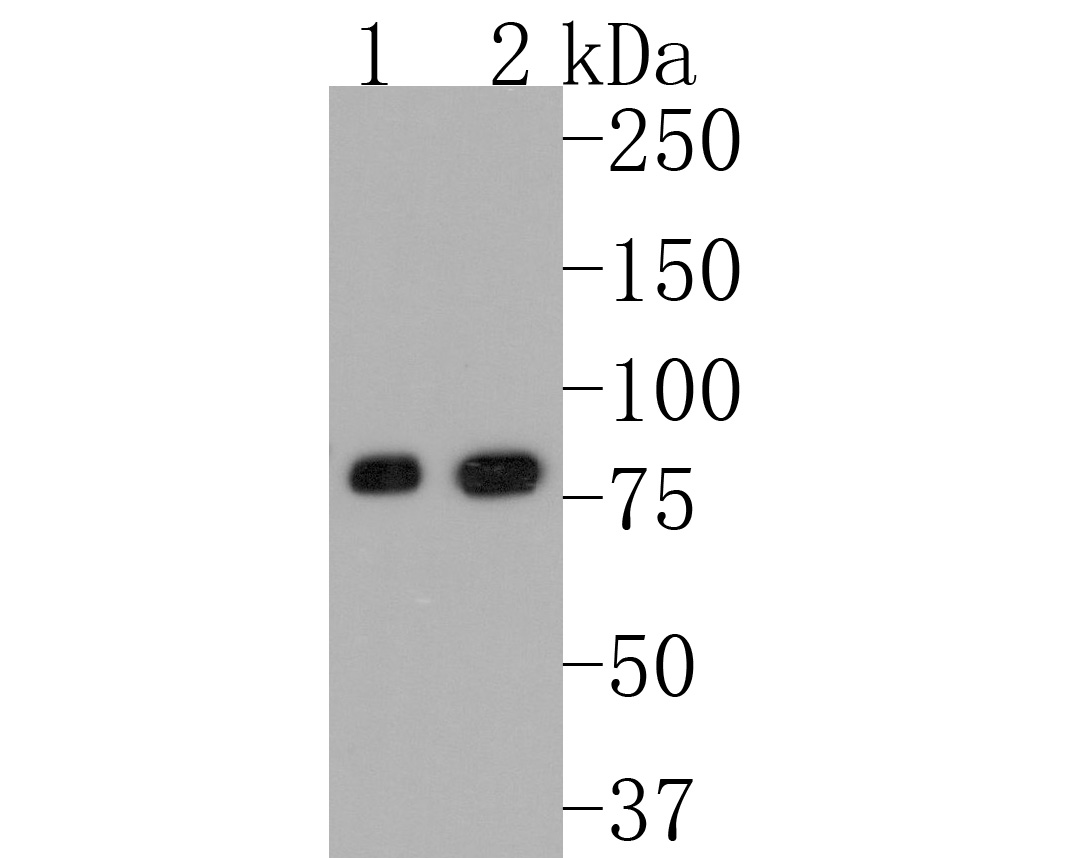Western blot analysis of Phospho-Glycogen synthase 1(S641) on different lysates. Proteins were transferred to a PVDF membrane and blocked with 5% BSA in PBS for 1 hour at room temperature. The primary antibody (ET1602-13, 1/500) was used in 5% BSA at room temperature for 2 hours. Goat Anti-Rabbit IgG - HRP Secondary Antibody (HA1001) at 1:200,000 dilution was used for 1 hour at room temperature.<br />
Positive control: <br />
Lane 1: SK-Br-3 cell lysate<br />
Lane 2: A431 cell lysate