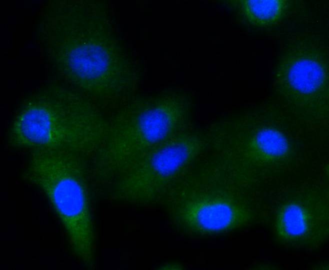 ICC staining of Phospho-Glycogen synthase 1(S641) in A549 cells (green). Formalin fixed cells were permeabilized with 0.1% Triton X-100 in TBS for 10 minutes at room temperature and blocked with 1% Blocker BSA for 15 minutes at room temperature. Cells were probed with the primary antibody (ET1602-13, 1/50) for 1 hour at room temperature, washed with PBS. Alexa Fluor®488 Goat anti-Rabbit IgG was used as the secondary antibody at 1/1,000 dilution. The nuclear counter stain is DAPI (blue).