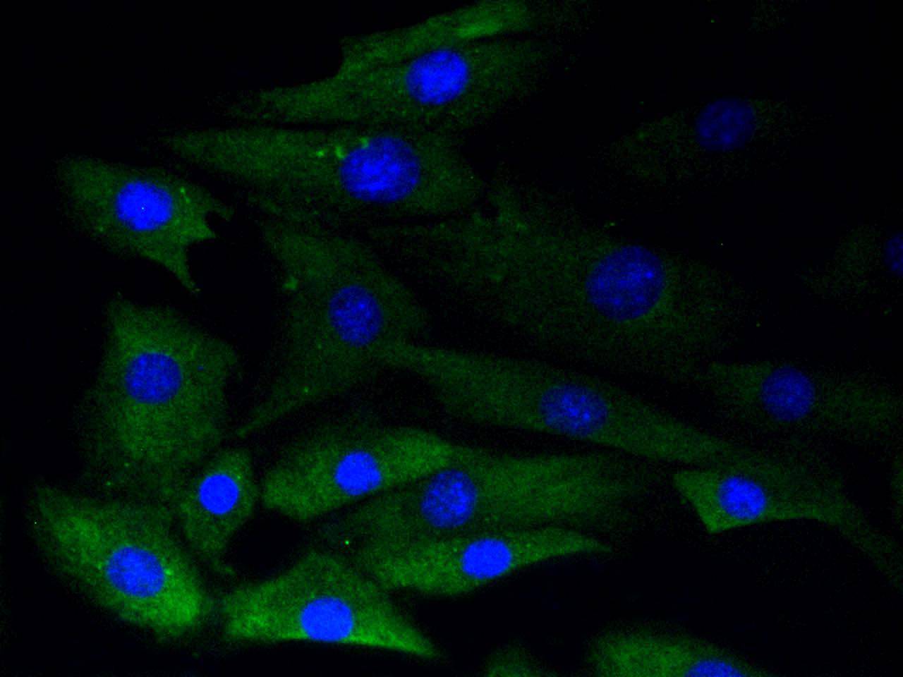 ICC staining of Phospho-Glycogen synthase 1(S641) in NIH/3T3 cells (green). Formalin fixed cells were permeabilized with 0.1% Triton X-100 in TBS for 10 minutes at room temperature and blocked with 1% Blocker BSA for 15 minutes at room temperature. Cells were probed with the primary antibody (ET1602-13, 1/50) for 1 hour at room temperature, washed with PBS. Alexa Fluor®488 Goat anti-Rabbit IgG was used as the secondary antibody at 1/1,000 dilution. The nuclear counter stain is DAPI (blue).