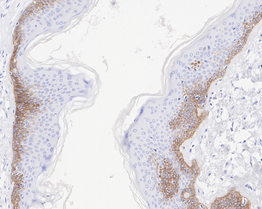 Immunohistochemical analysis of paraffin-embedded mouse skin tissue using anti-Collagen XVII antibody. The section was pre-treated using heat mediated antigen retrieval with Tris-EDTA buffer (pH 8.0-8.4) for 20 minutes.The tissues were blocked in 5% BSA for 30 minutes at room temperature, washed with ddH2O and PBS, and then probed with the primary antibody (ET1602-14, 1/50) for 30 minutes at room temperature. The detection was performed using an HRP conjugated compact polymer system. DAB was used as the chromogen. Tissues were counterstained with hematoxylin and mounted with DPX.