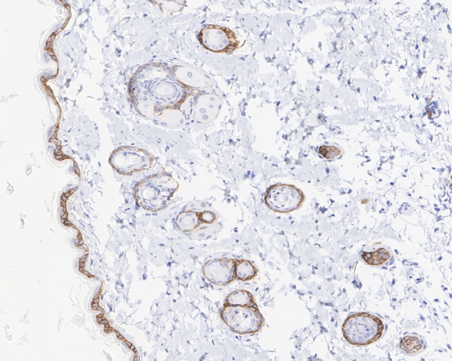Immunohistochemical analysis of paraffin-embedded human skin tissue with Rabbit anti-Collagen XVII antibody (ET1602-14) at 1/200 dilution.<br />
<br />
The section was pre-treated using heat mediated antigen retrieval with Tris-EDTA buffer (pH 9.0) for 20 minutes. The tissues were blocked in 1% BSA for 20 minutes at room temperature, washed with ddH2O and PBS, and then probed with the primary antibody (ET1602-14) at 1/200 dilution for 1 hour at room temperature. The detection was performed using an HRP conjugated compact polymer system. DAB was used as the chromogen. Tissues were counterstained with hematoxylin and mounted with DPX.