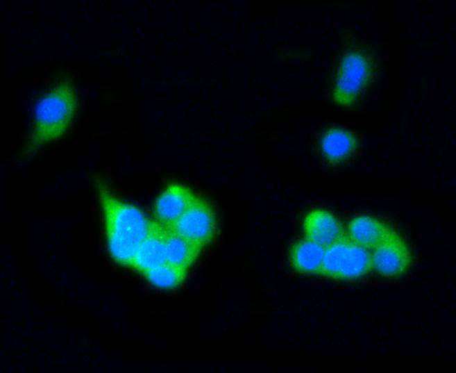 ICC staining of Rab4A in PC-12 cells (green). Formalin fixed cells were permeabilized with 0.1% Triton X-100 in TBS for 10 minutes at room temperature and blocked with 1% Blocker BSA for 15 minutes at room temperature. Cells were probed with the primary antibody (ET1602-15, 1/50) for 1 hour at room temperature, washed with PBS. Alexa Fluor®488 Goat anti-Rabbit IgG was used as the secondary antibody at 1/1,000 dilution. The nuclear counter stain is DAPI (blue).