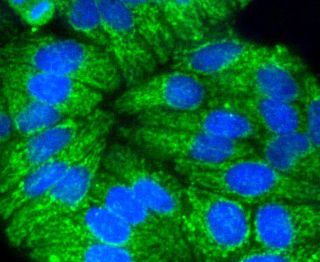 ICC staining of Cytokeratin 17 in Hela cells (green). Formalin fixed cells were permeabilized with 0.1% Triton X-100 in TBS for 10 minutes at room temperature and blocked with 1% Blocker BSA for 15 minutes at room temperature. Cells were probed with the primary antibody (ET1602-16, 1/50) for 1 hour at room temperature, washed with PBS. Alexa Fluor®488 Goat anti-Rabbit IgG was used as the secondary antibody at 1/1,000 dilution. The nuclear counter stain is DAPI (blue).