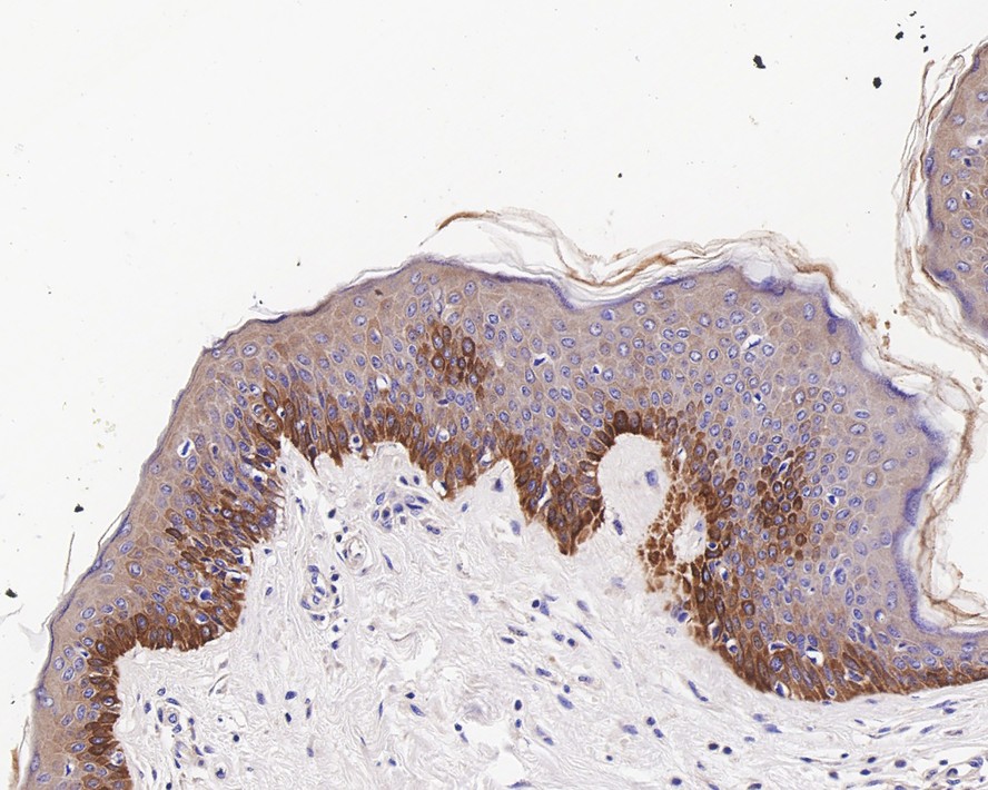 Immunohistochemical analysis of paraffin-embedded mouse prostate tissue using anti-Cytokeratin 17 antibody. The section was pre-treated using heat mediated antigen retrieval with Tris-EDTA buffer (pH 8.0-8.4) for 20 minutes.The tissues were blocked in 5% BSA for 30 minutes at room temperature, washed with ddH2O and PBS, and then probed with the primary antibody (ET1602-16, 1/50) for 30 minutes at room temperature. The detection was performed using an HRP conjugated compact polymer system. DAB was used as the chromogen. Tissues were counterstained with hematoxylin and mounted with DPX.