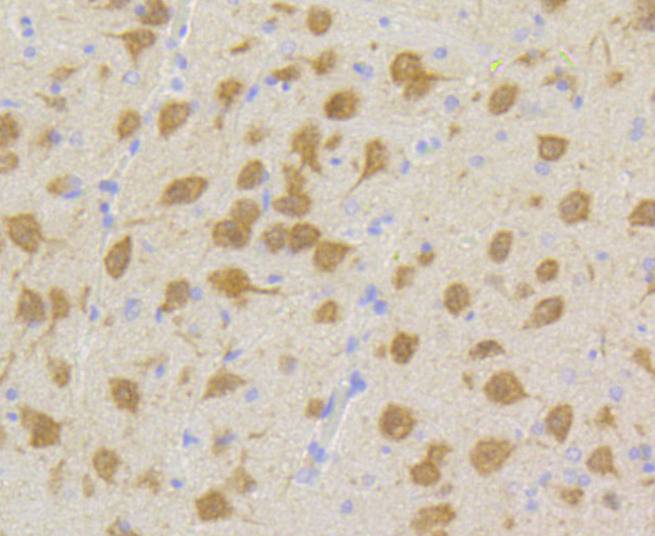 Immunohistochemical analysis of paraffin-embedded rat brain tissue using anti-Cdk5 antibody. The section was pre-treated using heat mediated antigen retrieval with Tris-EDTA buffer (pH 9.0) for 20 minutes.The tissues were blocked in 5% BSA for 30 minutes at room temperature, washed with ddH2O and PBS, and then probed with the primary antibody (ET1602-17, 1/50) for 30 minutes at room temperature. The detection was performed using an HRP conjugated compact polymer system. DAB was used as the chromogen. Tissues were counterstained with hematoxylin and mounted with DPX.