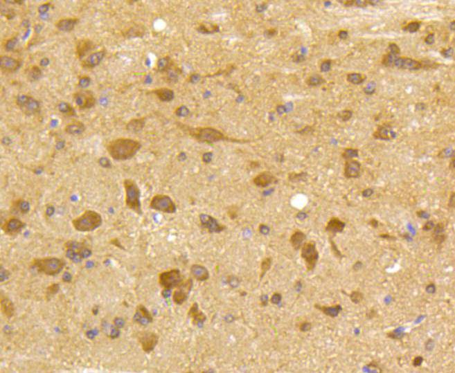 Immunohistochemical analysis of paraffin-embedded mouse brain tissue using anti-Cdk5 antibody. The section was pre-treated using heat mediated antigen retrieval with Tris-EDTA buffer (pH 9.0) for 20 minutes.The tissues were blocked in 5% BSA for 30 minutes at room temperature, washed with ddH2O and PBS, and then probed with the primary antibody (ET1602-17, 1/50) for 30 minutes at room temperature. The detection was performed using an HRP conjugated compact polymer system. DAB was used as the chromogen. Tissues were counterstained with hematoxylin and mounted with DPX.