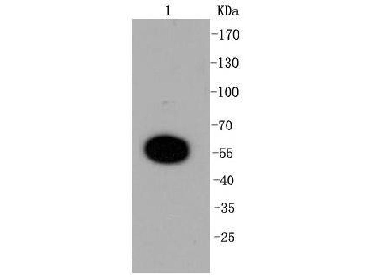 Western blot analysis of DUSP6 on mouse pancreas tissue lysates. Proteins were transferred to a PVDF membrane and blocked with 5% BSA in PBS for 1 hour at room temperature. The primary antibody (ET1602-18, 1/500) was used in 5% BSA at room temperature for 2 hours. Goat Anti-Rabbit IgG - HRP Secondary Antibody (HA1001) at 1:5,000 dilution was used for 1 hour at room temperature.<br />
<br />
Predicted band size: 42 kDa<br />
Observed band size: 55 kDa