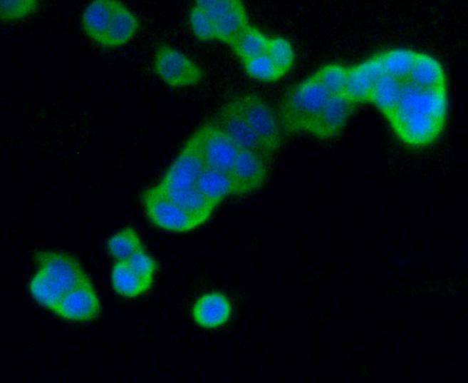 ICC staining of DUSP6 in PC-12 cells (green). Formalin fixed cells were permeabilized with 0.1% Triton X-100 in TBS for 10 minutes at room temperature and blocked with 1% Blocker BSA for 15 minutes at room temperature. Cells were probed with the primary antibody (ET1602-18, 1/50) for 1 hour at room temperature, washed with PBS. Alexa Fluor®488 Goat anti-Rabbit IgG was used as the secondary antibody at 1/1,000 dilution. The nuclear counter stain is DAPI (blue).