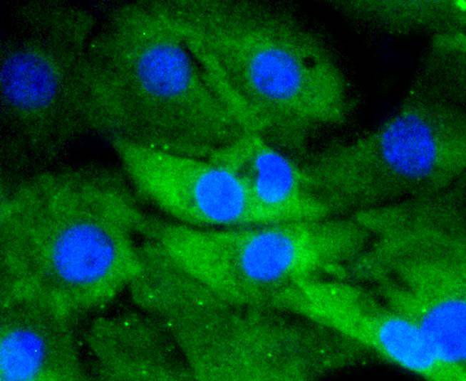 ICC staining of DUSP6 in NIH/3T3 cells (green). Formalin fixed cells were permeabilized with 0.1% Triton X-100 in TBS for 10 minutes at room temperature and blocked with 1% Blocker BSA for 15 minutes at room temperature. Cells were probed with the primary antibody (ET1602-18, 1/50) for 1 hour at room temperature, washed with PBS. Alexa Fluor®488 Goat anti-Rabbit IgG was used as the secondary antibody at 1/1,000 dilution. The nuclear counter stain is DAPI (blue).