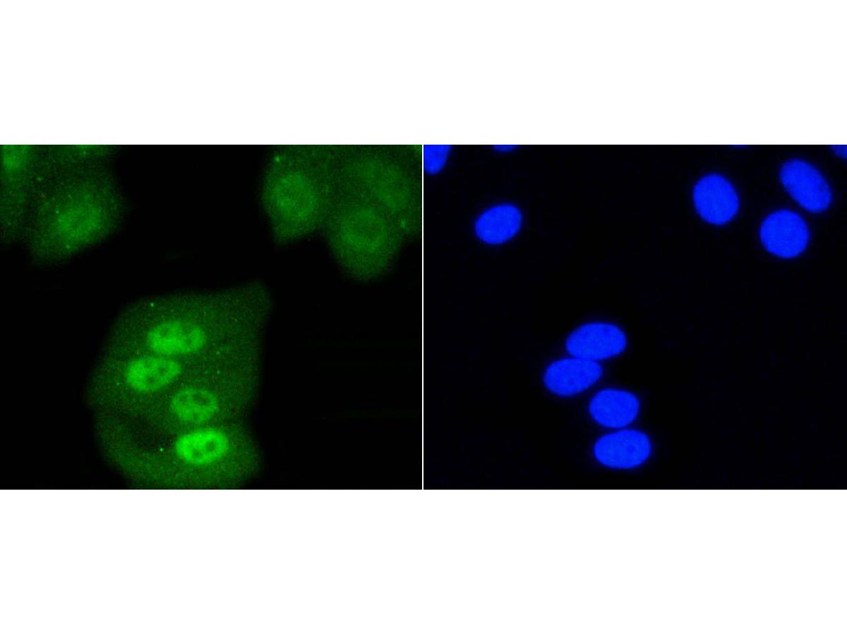 ICC staining of SHP1 in HepG2 cells (green). Formalin fixed cells were permeabilized with 0.1% Triton X-100 in TBS for 10 minutes at room temperature and blocked with 1% Blocker BSA for 15 minutes at room temperature. Cells were probed with the primary antibody (ET1602-19, 1/50) for 1 hour at room temperature, washed with PBS. Alexa Fluor®488 Goat anti-Rabbit IgG was used as the secondary antibody at 1/1,000 dilution. The nuclear counter stain is DAPI (blue).