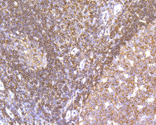 Immunohistochemical analysis of paraffin-embedded human tonsil tissue using anti-SHP1 antibody. The section was pre-treated using heat mediated antigen retrieval with Tris-EDTA buffer (pH 8.0-8.4) for 20 minutes.The tissues were blocked in 5% BSA for 30 minutes at room temperature, washed with ddH2O and PBS, and then probed with the primary antibody (ET1602-19, 1/1,000) for 30 minutes at room temperature. The detection was performed using an HRP conjugated compact polymer system. DAB was used as the chromogen. Tissues were counterstained with hematoxylin and mounted with DPX.