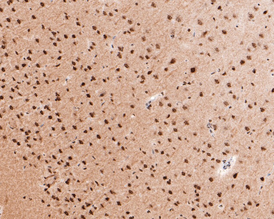 Immunohistochemical analysis of paraffin-embedded mouse testis tissue with Rabbit anti-Phospho-Histone H2A.X(S139) antibody (ET1602-2) at 1/500 dilution.<br />
<br />
The section was pre-treated using heat mediated antigen retrieval with sodium citrate buffer (pH 6.0) for 2 minutes. The tissues were blocked in 1% BSA for 20 minutes at room temperature, washed with ddH2O and PBS, and then probed with the primary antibody (ET1602-2) at 1/500 dilution for 1 hour at room temperature. The detection was performed using an HRP conjugated compact polymer system. DAB was used as the chromogen. Tissues were counterstained with hematoxylin and mounted with DPX.