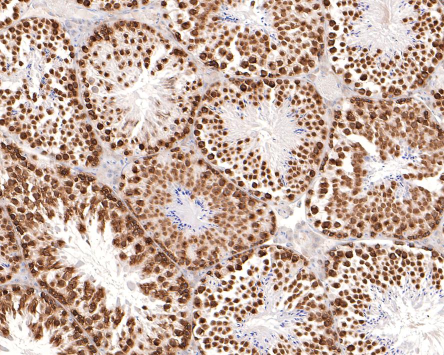Immunohistochemical analysis of paraffin-embedded mouse brain tissue with Rabbit anti-Phospho-Histone H2A.X(S139) antibody (ET1602-2) at 1/50 dilution.<br />
<br />
The section was pre-treated using heat mediated antigen retrieval with sodium citrate buffer (pH 6.0) for 2 minutes. The tissues were blocked in 1% BSA for 20 minutes at room temperature, washed with ddH2O and PBS, and then probed with the primary antibody (ET1602-2) at 1/50 dilution for 1 hour at room temperature. The detection was performed using an HRP conjugated compact polymer system. DAB was used as the chromogen. Tissues were counterstained with hematoxylin and mounted with DPX.