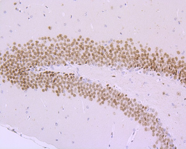 Immunohistochemical analysis of paraffin-embedded mouse small intestine tissue with Rabbit anti-Phospho-Histone H2A.X(S139) antibody (ET1602-2) at 1/500 dilution.<br />
<br />
The section was pre-treated using heat mediated antigen retrieval with sodium citrate buffer (pH 6.0) for 2 minutes. The tissues were blocked in 1% BSA for 20 minutes at room temperature, washed with ddH2O and PBS, and then probed with the primary antibody (ET1602-2) at 1/500 dilution for 1 hour at room temperature. The detection was performed using an HRP conjugated compact polymer system. DAB was used as the chromogen. Tissues were counterstained with hematoxylin and mounted with DPX.